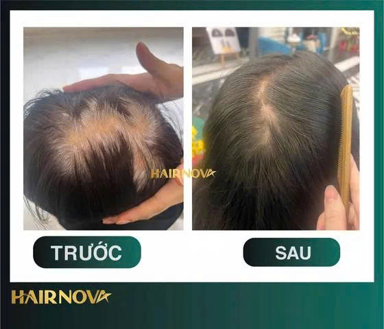 Đào tạo Chăm sóc Da cơ bản